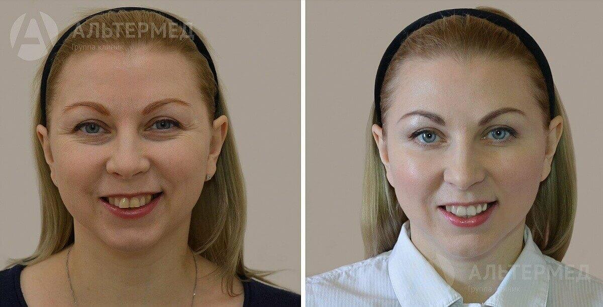 Что делать когда ногти плохо растут Что делать когда ногти плохо растут