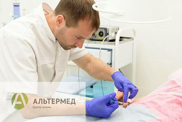 Альтермед на просвещения удаление бородавок